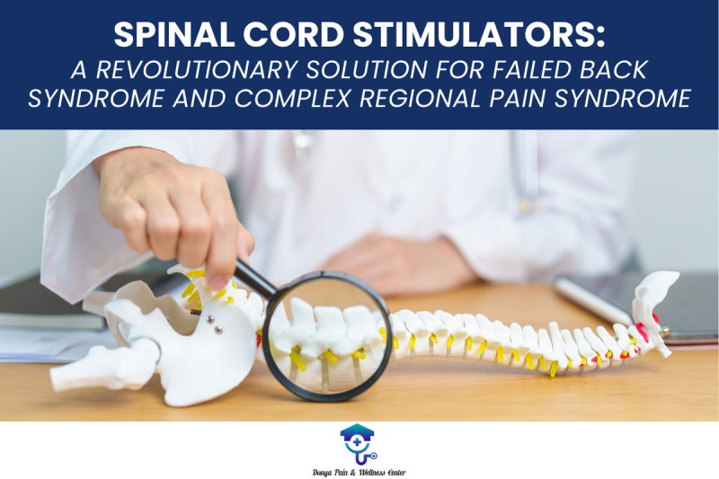 Spinal Cord Stimulators A Revolutionary Solution for Failed Back Syndrome and Complex Regional Pain Syndrome